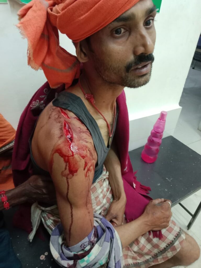 Late Night Robbery Attempt in Nayagarh Father and Son Seriously Injured in Knife Attack